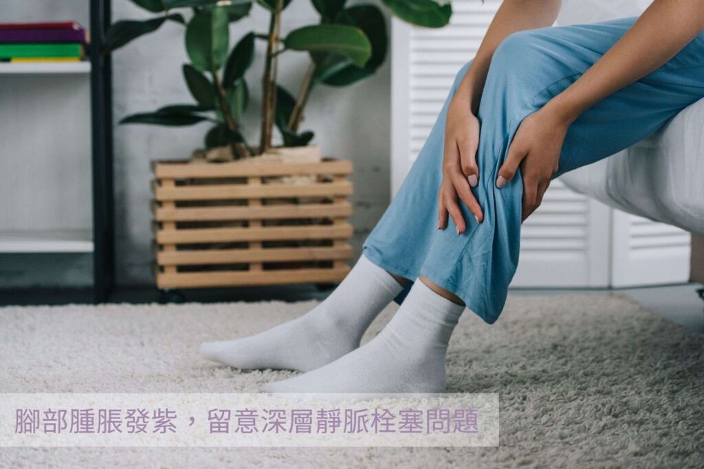 腳發紫、脹痛?!及時治療,搶通深層靜脈栓塞 - 封面圖
