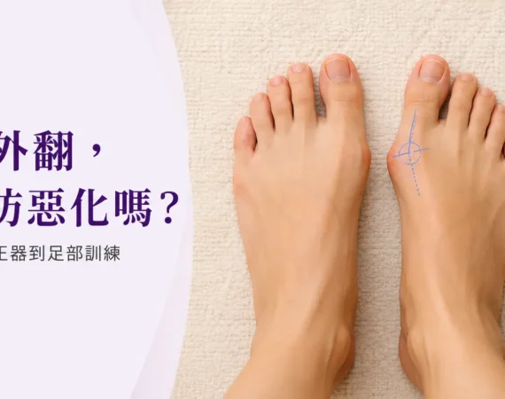 正常足與拇趾外翻足型對比，外翻側標偏移角度
