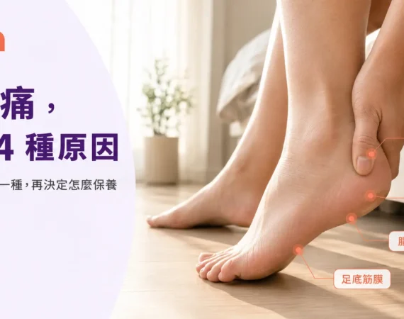 腳跟痛常見四種原因的足部位置示意圖