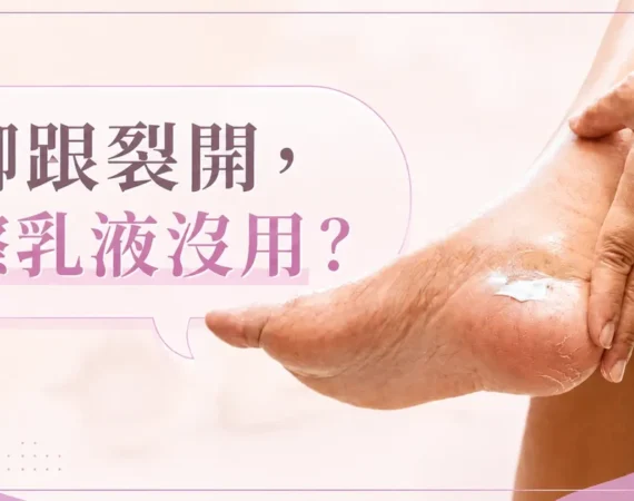 赤足腳跟側面與一罐乳霜並置的居家照片，帶出腳跟龜裂與保養品選擇的主題。