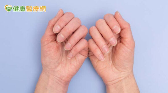 從指甲看健康警訊可能是心肺出問題！小心顏色、形狀的… - 封面圖