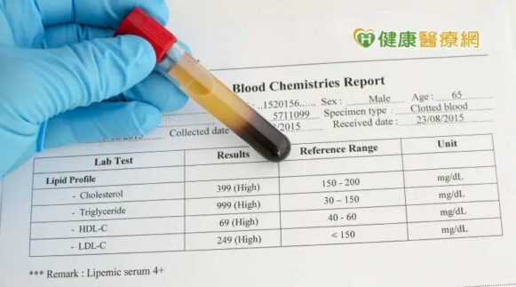 壯世代定期健檢關心自身健康！應做哪些健檢項目？健檢… - 封面圖