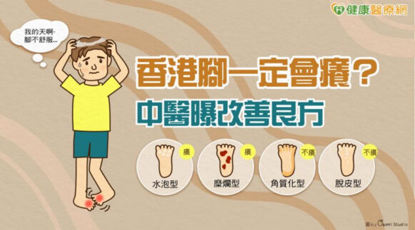 香港腳一定會癢？中醫曝改善良方 - 封面圖