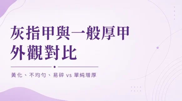 灰指甲與一般厚甲外觀辨識對比示意圖