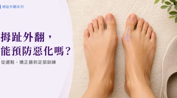 正常足與拇趾外翻足型對比，外翻側標偏移角度