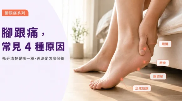腳跟痛常見四種原因的足部位置示意圖