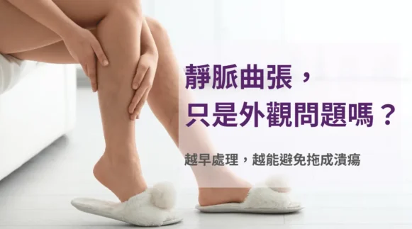 坐姿抬腿放鬆小腿的居家情境，說明下肢靜脈回流與日常照護