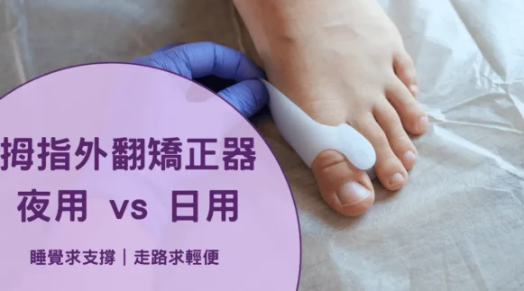 矯正器，夜用 vs 日用